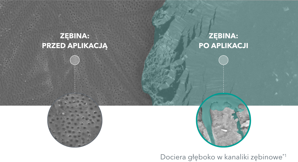 ZĘBINA: PRZED APLIKACJĄ ZĘBINA: PRZED APLIKACJĄ