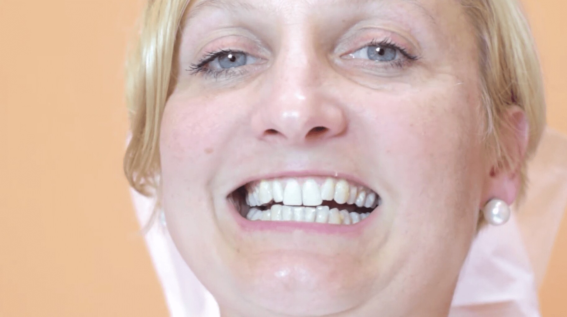 Wideo Instruktaż aplikacji lakieru Duraphat Materiały dla